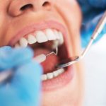 Apa Saja Jenis Perawatan yang Dilakukan untuk Perbaikan Kerusakan Gigi?